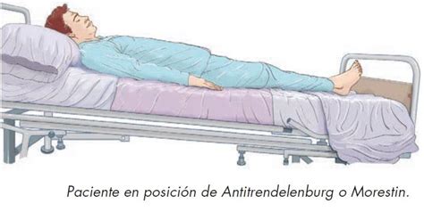 Posicion De Morestin