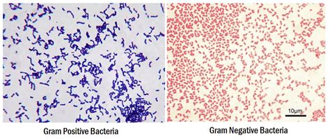 Positive And Negative Staining
