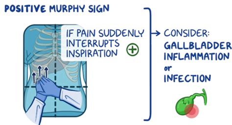 Positive Murphy Sign