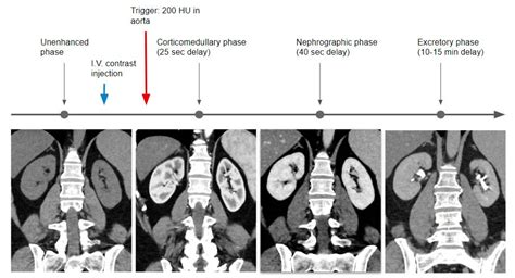 Positive Pressure Urography