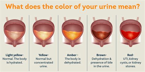 possible causes of blood in urine