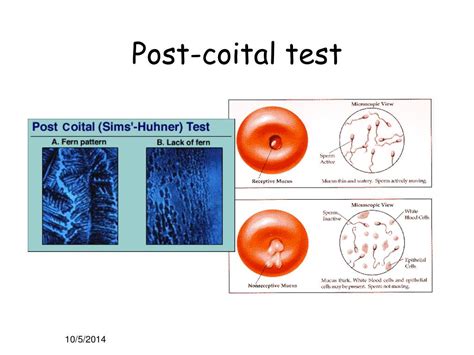 Post Coital Test