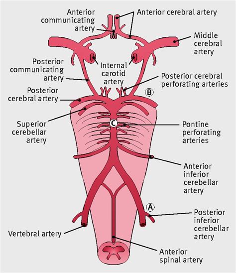 Posterior Circulation Stroke