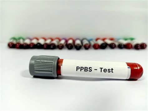 Ppbs Blood Test