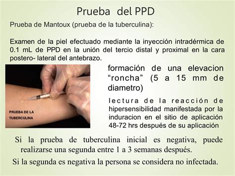 Ppd Que Es