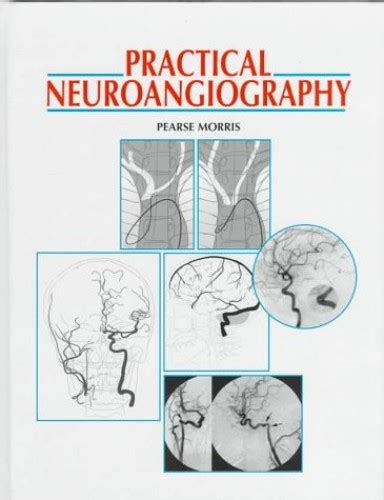practical neuroangiography