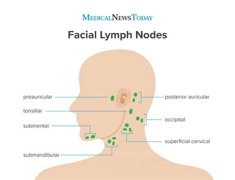 Preauricular Lymph Node Swelling