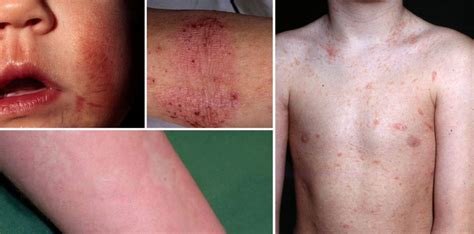 prickar barn ansikte