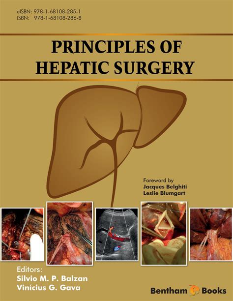 Principles Of Hepatic Surgery