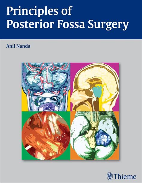 Principles Of Posterior Fossa Surgery Surgical Management