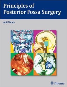 Download Principles Of Posterior Fossa Surgery Surgical Management 