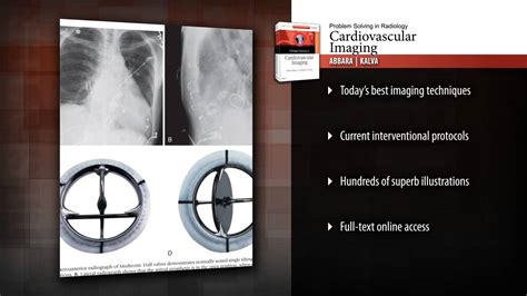 Full Download Problem Solving In Radiology Cardiovascular Imaging 