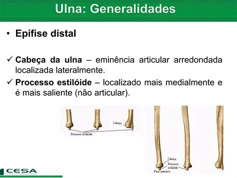 Processo Estiloide Do Radio