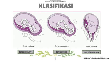 Prolaps Tali Pusat