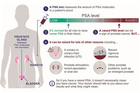 Prostate Cancer Psa Level Chart