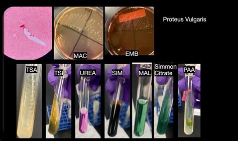 Download Proteus Vulgaris Unknown Lab Report 