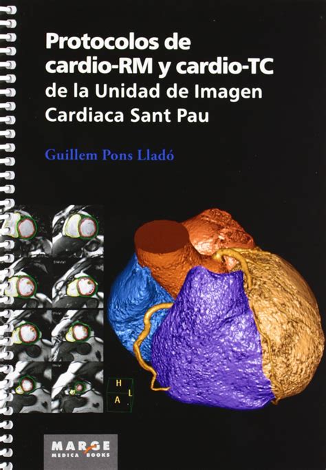 protocolos de cardio rm y cardio tc de la unidad