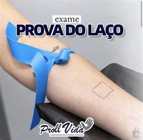 Prova De Laço