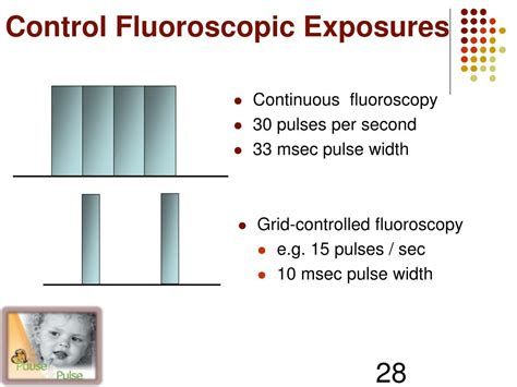 Pulsed Fluoroscopy Will Increase Patient Dose Quizlet