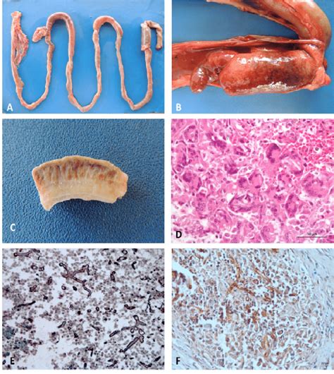 pythiosis; swamp cancer? The Horse Forum