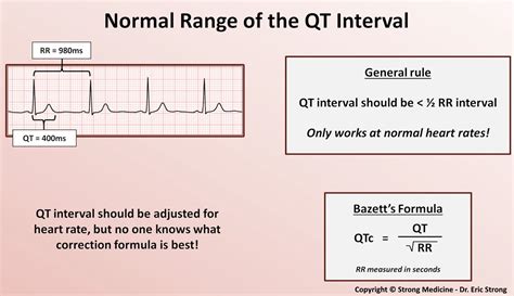 Qt Interval Calculator