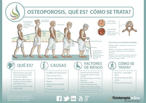Que Es Osteopenia
