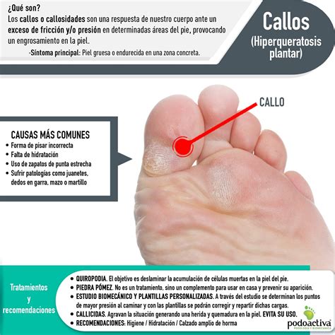 Que Son Los Callos