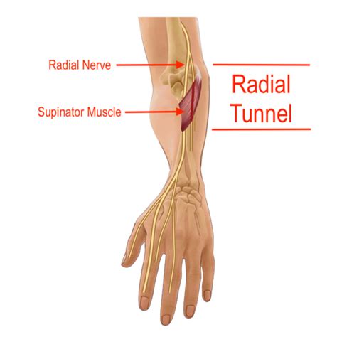 Radial Nerve Nerve