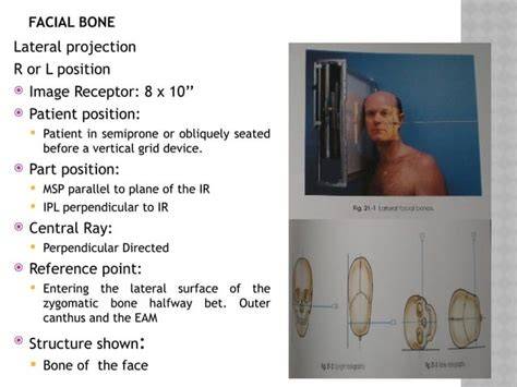 radiographic positioning ii clovis community college