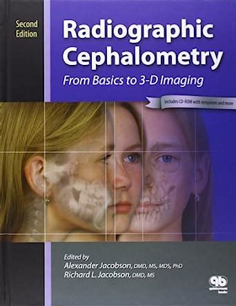Download Radiographic Cephalometry From Basics To Videoimaging 
