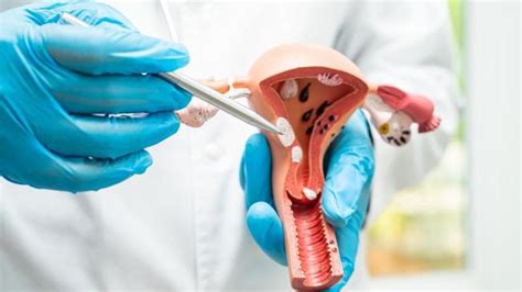 rahim retro | saya hamil dengan jenis rahim RETRO adakah