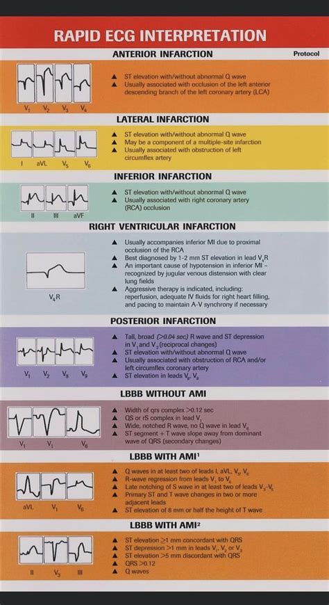 Full Download Rapid Ecg Interpretation 