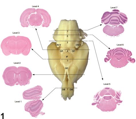 Read Online Rat Brain Dissection Guide 
