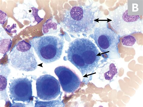 reactive mesothelial cells cytology