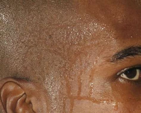 reason for sweating in head while sleeping