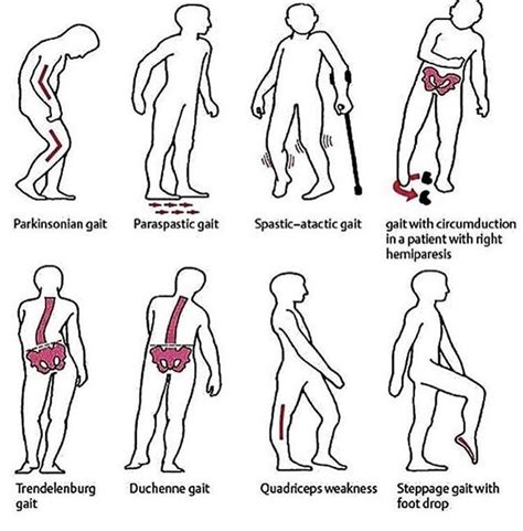 Recognizing Human Gait Types
