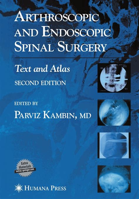 Recommended Text Spinal Surgery