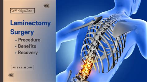 Recommended Texts Laminectomy