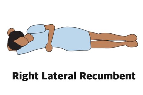 Recumbent Lateral Position