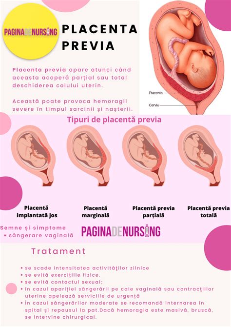 referat placenta previa pdf