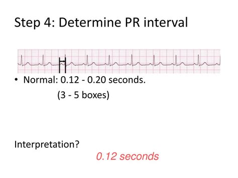 Regular Pr Interval