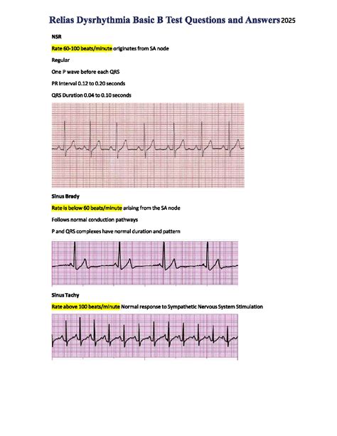 Relias Dysrhythmia Basic B Test Answers
