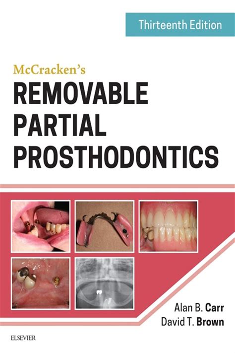 Removable Partial Prosthodontics 2 E