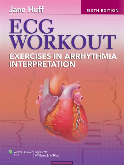 Full Download Rent Ecg Workout 6Th Edition 
