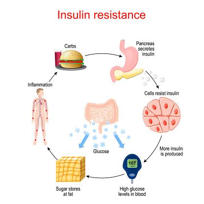 resistensi insulin adalah