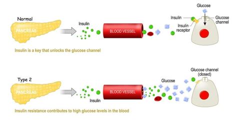 resistentie betekenis