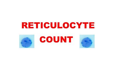 reticulocyte count - UpToDate