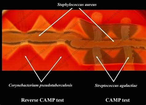 Reverse Camp Test