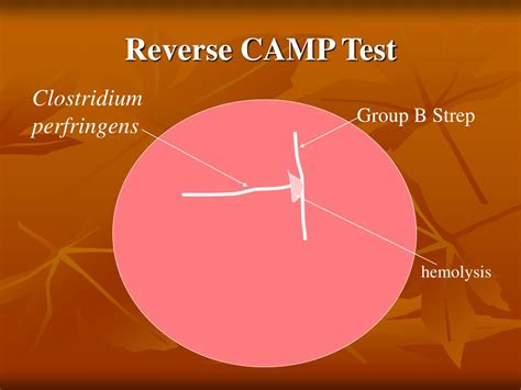 Image related to reverse-camp-test