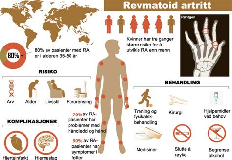revmatoid artritt behandling